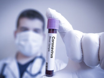 No more COVID-19 tests for minor symptoms in Oman: Specialist